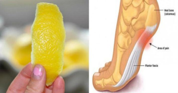 Лимонная кожура против воспаления и боли